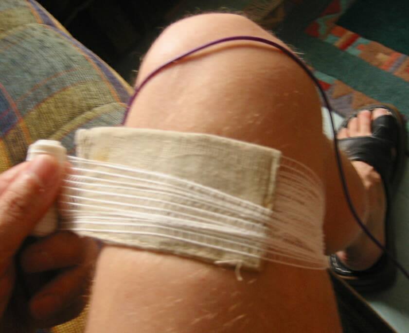 Wplatanie aplikatora siatkowego w bandaż